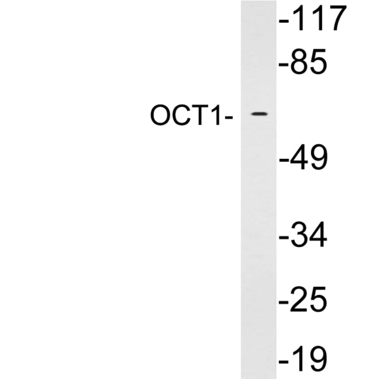 Western Blot - Anti-OCT1 Antibody (R12-2282) - Antibodies.com