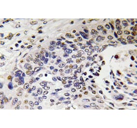 Immunohistochemistry - Anti-NF-H Antibody (R12-2261) - Antibodies.com