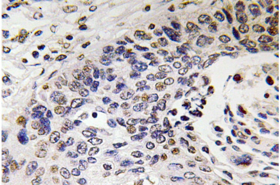 Immunohistochemistry - Anti-NF-H Antibody (R12-2261) - Antibodies.com