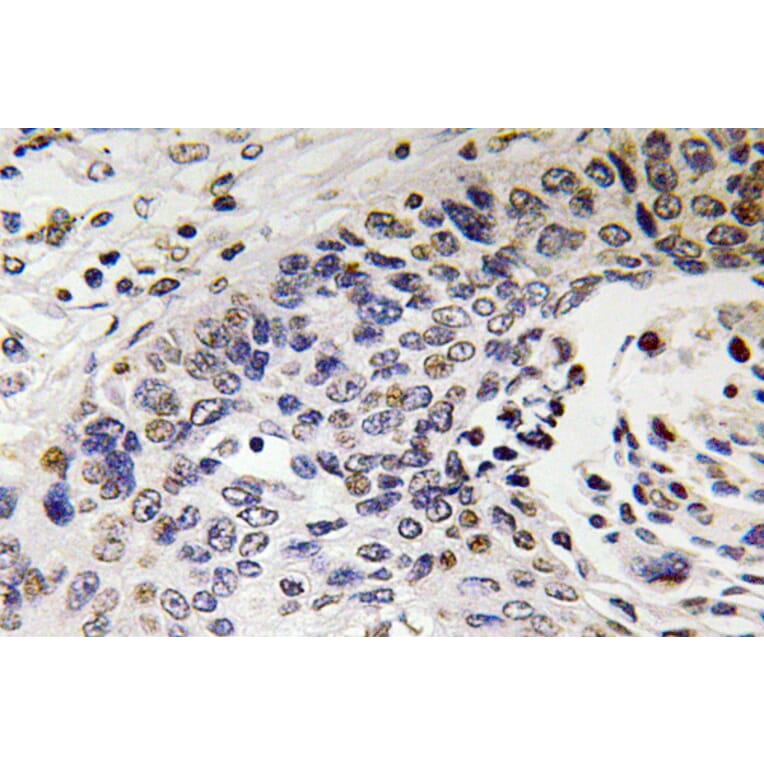Immunohistochemistry - Anti-NF-H Antibody (R12-2261) - Antibodies.com