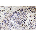 Immunohistochemistry - Anti-NF-H Antibody (R12-2261) - Antibodies.com