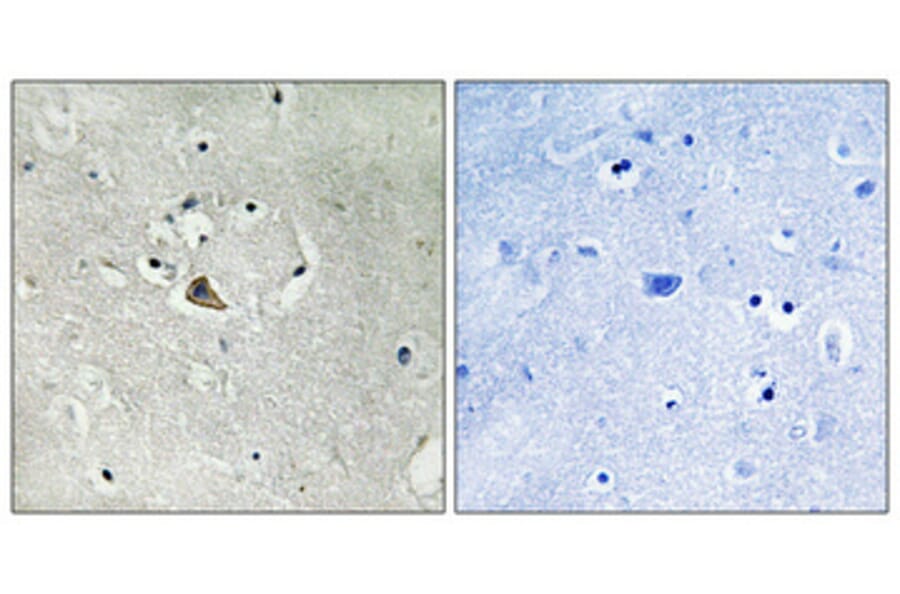 Immunohistochemistry - Anti-MUC1 Antibody (B8377) - Antibodies.com