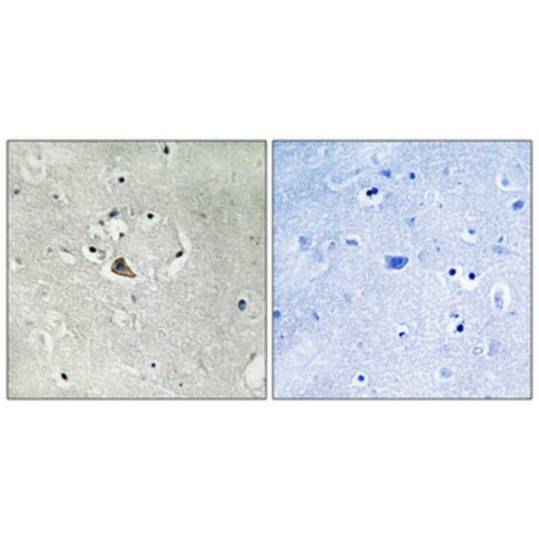 Immunohistochemistry - Anti-MUC1 Antibody (B8377) - Antibodies.com