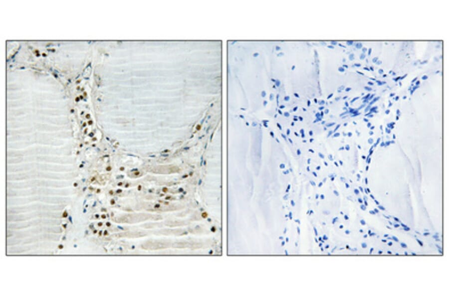 Immunohistochemistry - Anti-HBP1 Antibody (B1035) - Antibodies.com