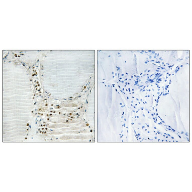 Immunohistochemistry - Anti-HBP1 Antibody (B1035) - Antibodies.com