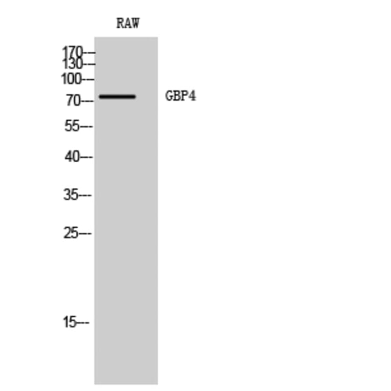 Western Blot - Anti-GBP4 Antibody (C16081) - Antibodies.com