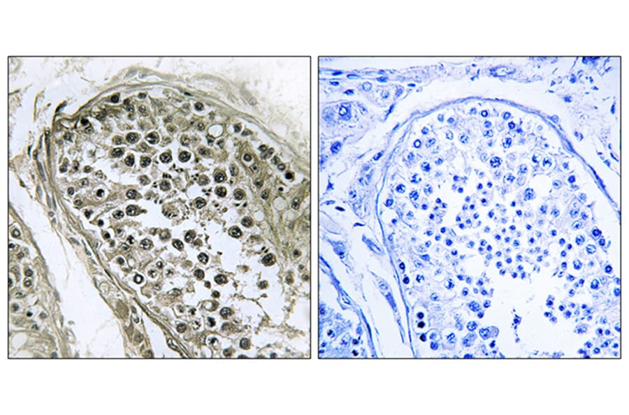 Immunohistochemistry - Anti-GAB4 Antibody (C12388) - Antibodies.com