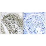Immunohistochemistry - Anti-GAB4 Antibody (C12388) - Antibodies.com