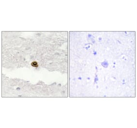 Immunohistochemistry - Anti-DGKZ Antibody (C10999) - Antibodies.com
