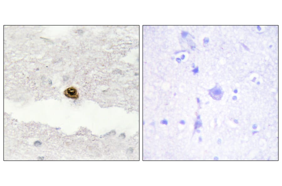 Immunohistochemistry - Anti-DGKZ Antibody (C10999) - Antibodies.com