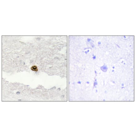 Immunohistochemistry - Anti-DGKZ Antibody (C10999) - Antibodies.com