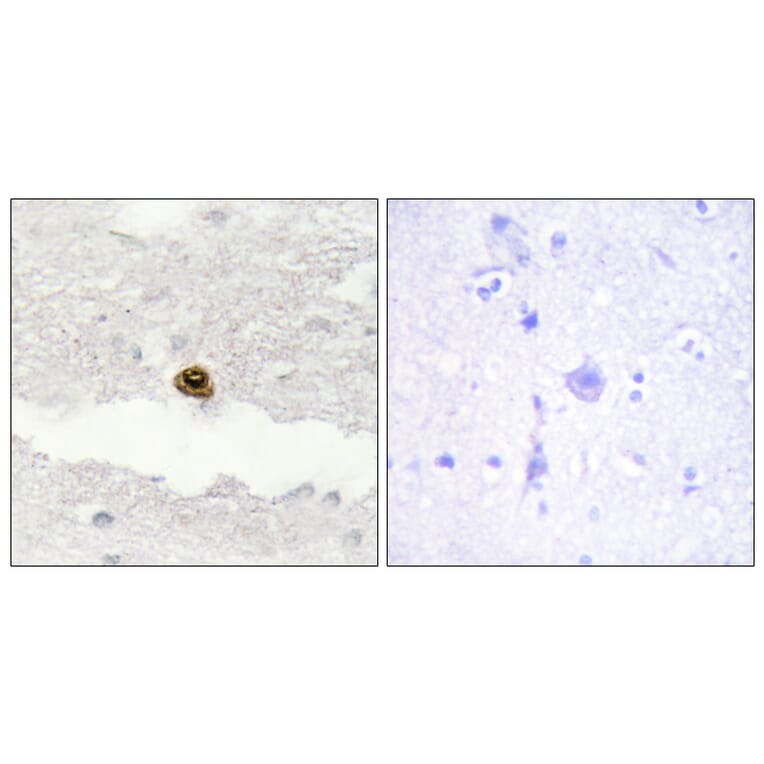 Immunohistochemistry - Anti-DGKZ Antibody (C10999) - Antibodies.com