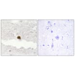 Immunohistochemistry - Anti-DGKZ Antibody (C10999) - Antibodies.com
