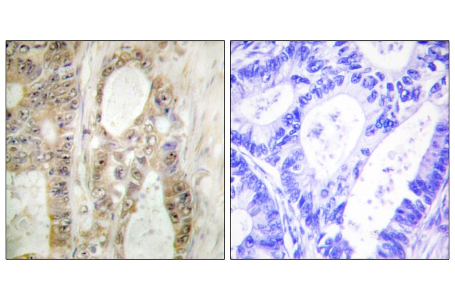 Immunohistochemistry - Anti-Chk1 Antibody (B0629) - Antibodies.com