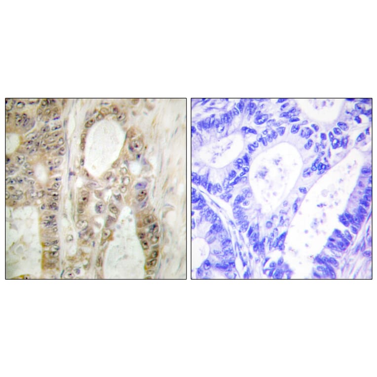 Immunohistochemistry - Anti-Chk1 Antibody (B0629) - Antibodies.com