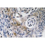 Immunohistochemistry - Anti-CD63 Antibody (R12-2081) - Antibodies.com