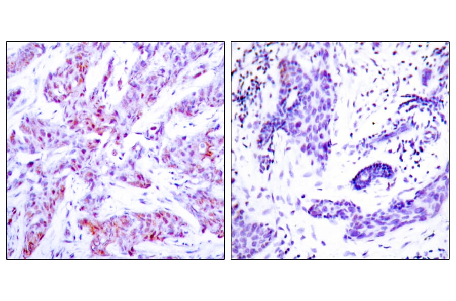 Immunohistochemistry - Anti-ATF4 Antibody (B7017) - Antibodies.com
