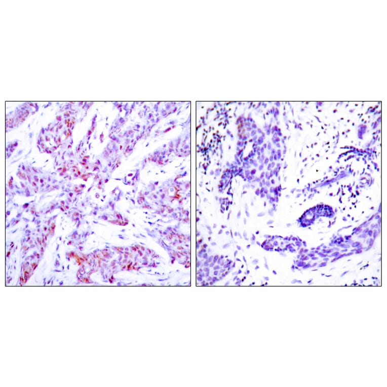 Immunohistochemistry - Anti-ATF4 Antibody (B7017) - Antibodies.com
