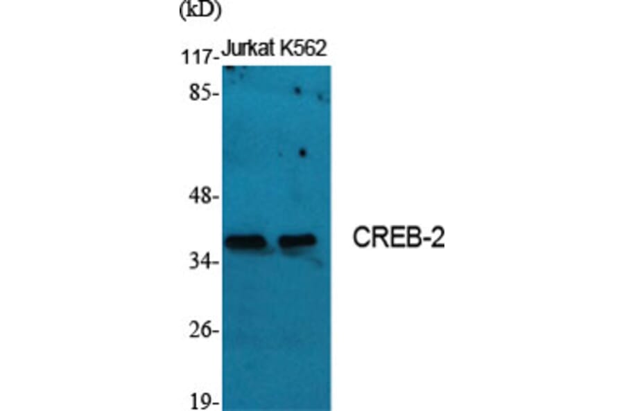 Western Blot - Anti-ATF4 Antibody (B7017) - Antibodies.com