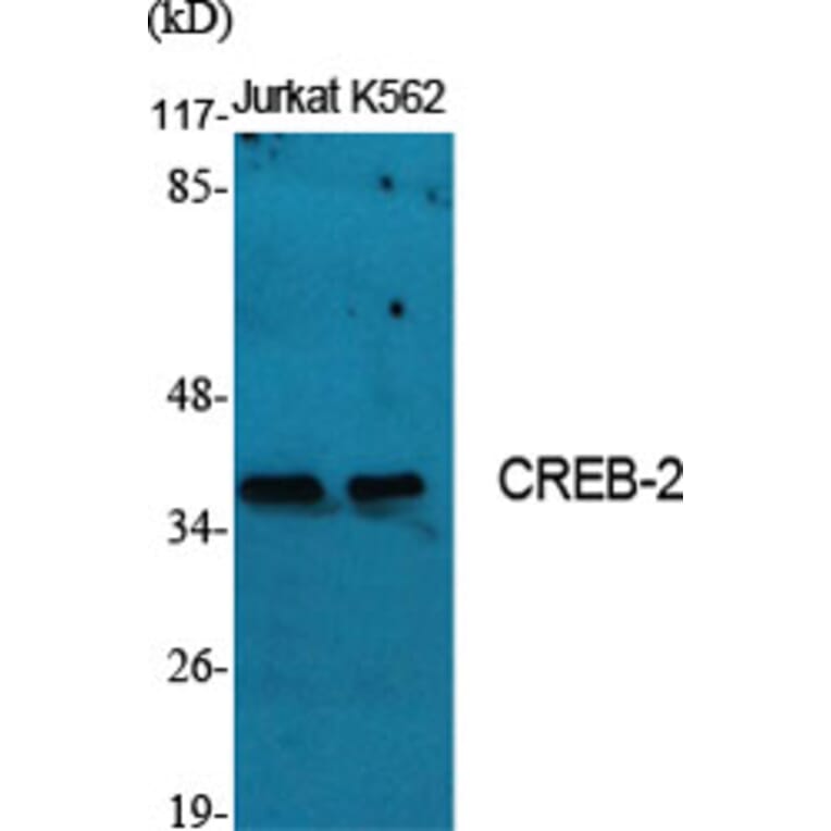 Western Blot - Anti-ATF4 Antibody (B7017) - Antibodies.com