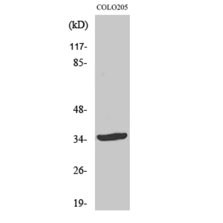 Western Blot - Anti-YOD1 Antibody (C19411) - Antibodies.com