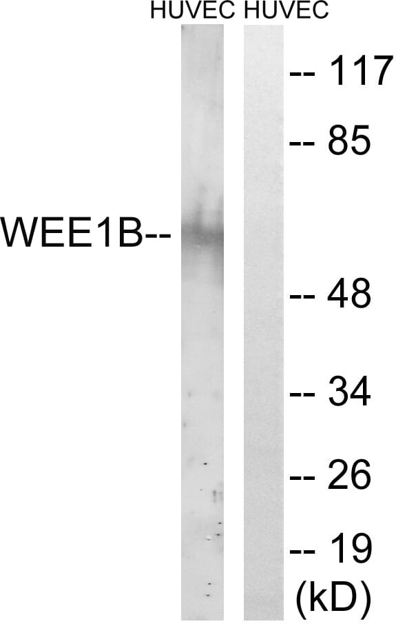Western blot analysis of lysates from HUVEC cells using Anti-WEE2 Antibody. The right hand lane represents a negative control, where the antibody is blocked by the immunising peptide.