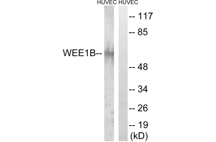 Western Blot - Anti-WEE2 Antibody (C19556) - Antibodies.com