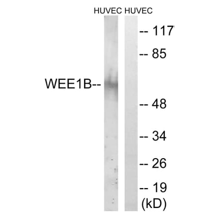Western Blot - Anti-WEE2 Antibody (C19556) - Antibodies.com