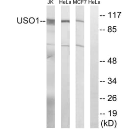Western Blot - Anti-USO1 Antibody (C15909) - Antibodies.com