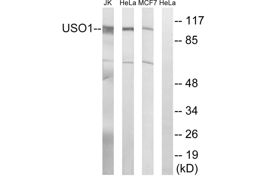 Western Blot - Anti-USO1 Antibody (C15909) - Antibodies.com
