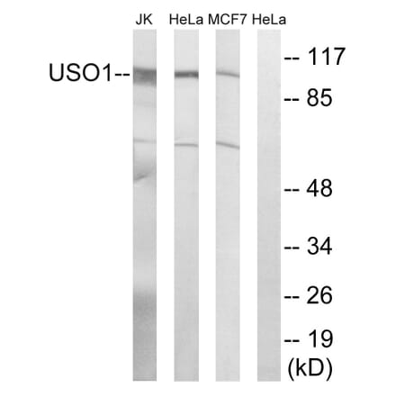 Western Blot - Anti-USO1 Antibody (C15909) - Antibodies.com