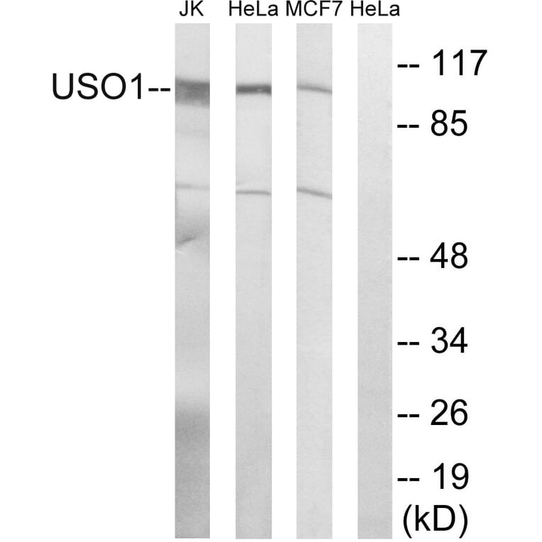 Western Blot - Anti-USO1 Antibody (C15909) - Antibodies.com