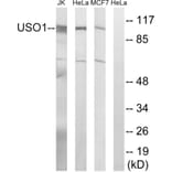 Western Blot - Anti-USO1 Antibody (C15909) - Antibodies.com