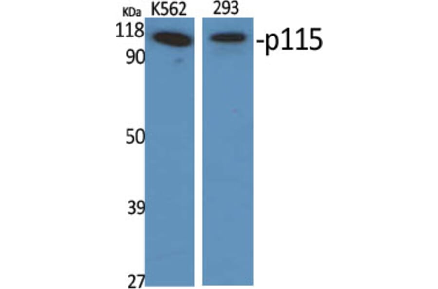 Western Blot - Anti-USO1 Antibody (C15909) - Antibodies.com