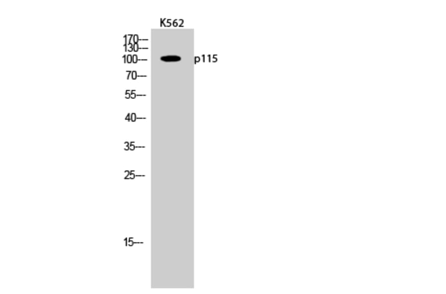 Western Blot - Anti-USO1 Antibody (C15909) - Antibodies.com