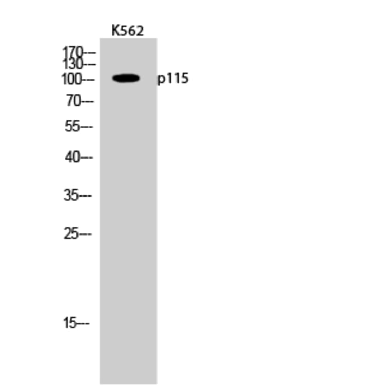 Western Blot - Anti-USO1 Antibody (C15909) - Antibodies.com
