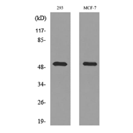 Western Blot - Anti-TYMP Antibody (C30660) - Antibodies.com