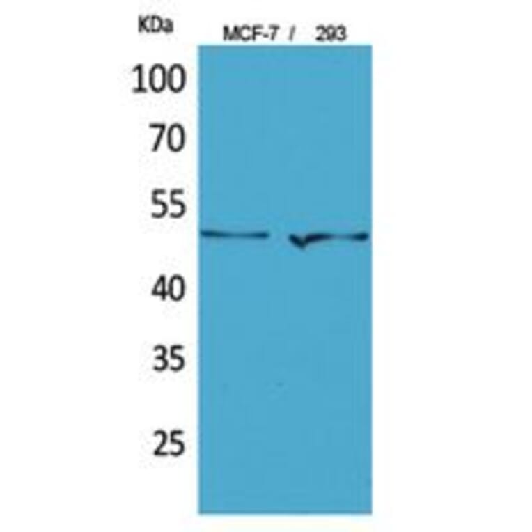 Western Blot - Anti-TYMP Antibody (C30660) - Antibodies.com