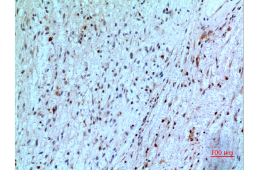 Immunohistochemistry - Anti-TYMP Antibody (C30660) - Antibodies.com