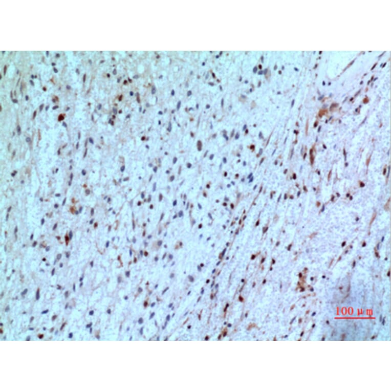 Immunohistochemistry - Anti-TYMP Antibody (C30660) - Antibodies.com