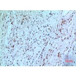 Immunohistochemistry - Anti-TYMP Antibody (C30660) - Antibodies.com
