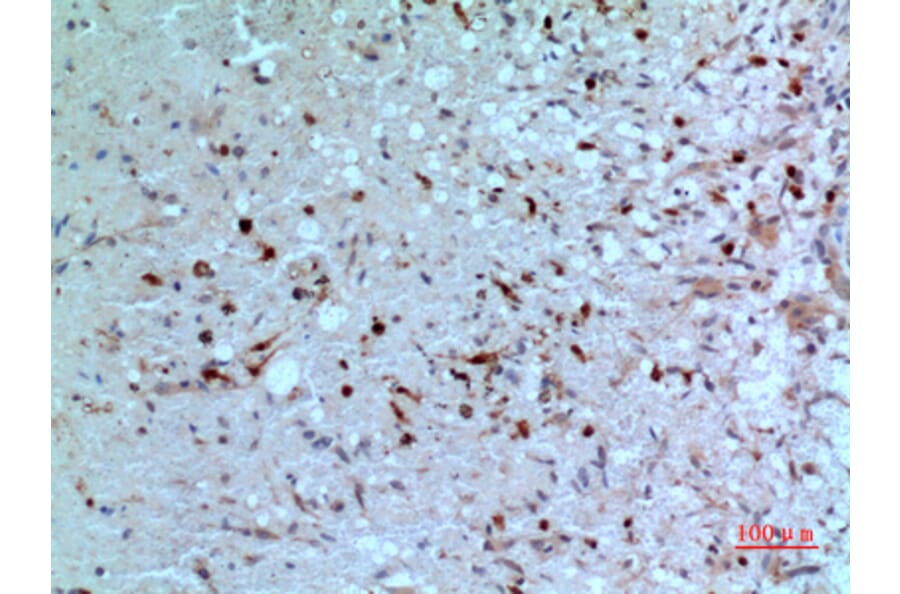 Immunohistochemistry - Anti-TYMP Antibody (C30660) - Antibodies.com