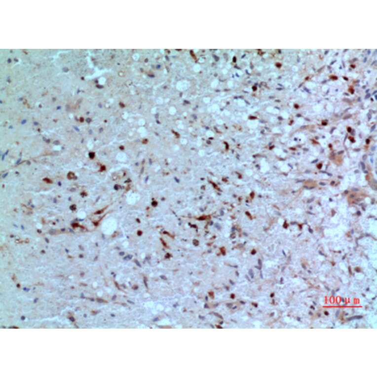 Immunohistochemistry - Anti-TYMP Antibody (C30660) - Antibodies.com