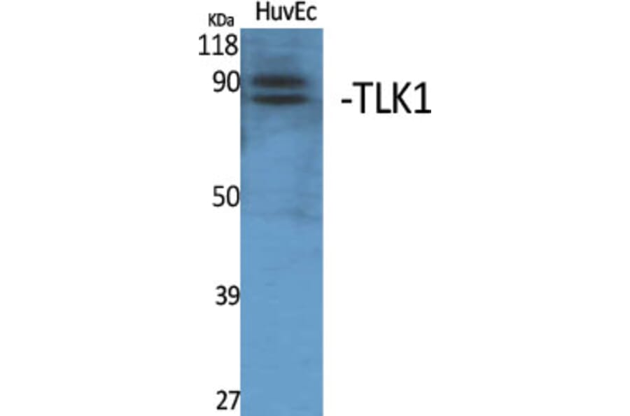 Western Blot - Anti-TLK1 Antibody (C21199) - Antibodies.com