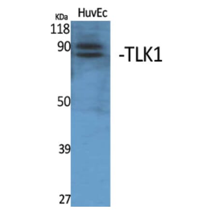 Western Blot - Anti-TLK1 Antibody (C21199) - Antibodies.com