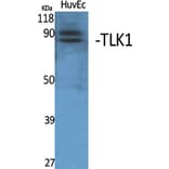 Western Blot - Anti-TLK1 Antibody (C21199) - Antibodies.com