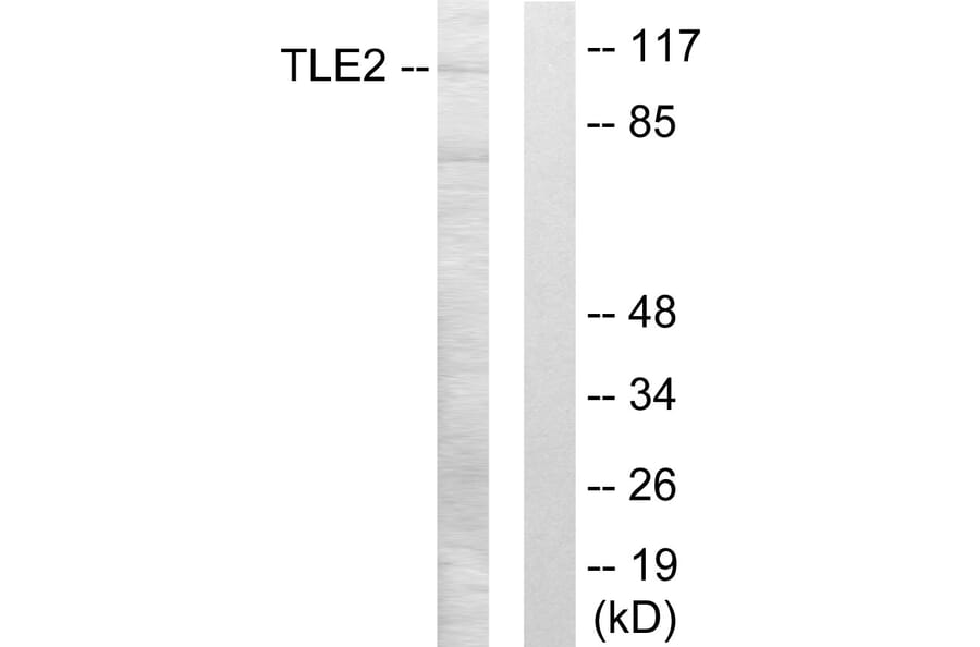 Western Blot - Anti-TLE2 Antibody (C10874) - Antibodies.com