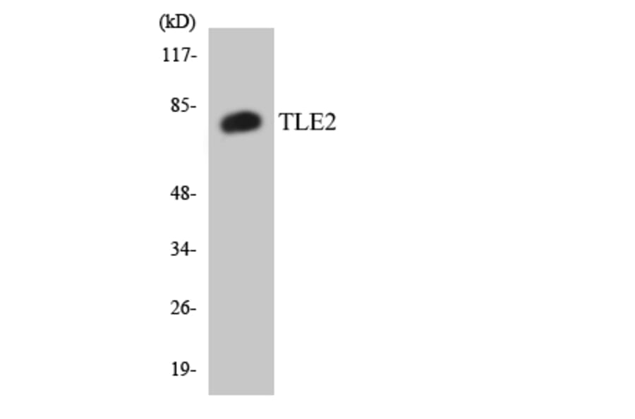Western Blot - Anti-TLE2 Antibody (R12-3627) - Antibodies.com