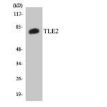Western Blot - Anti-TLE2 Antibody (R12-3627) - Antibodies.com