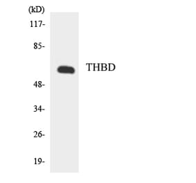 Western Blot - Anti-THBD Antibody (R12-3621) - Antibodies.com